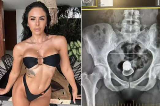 Plug anal atriz porno